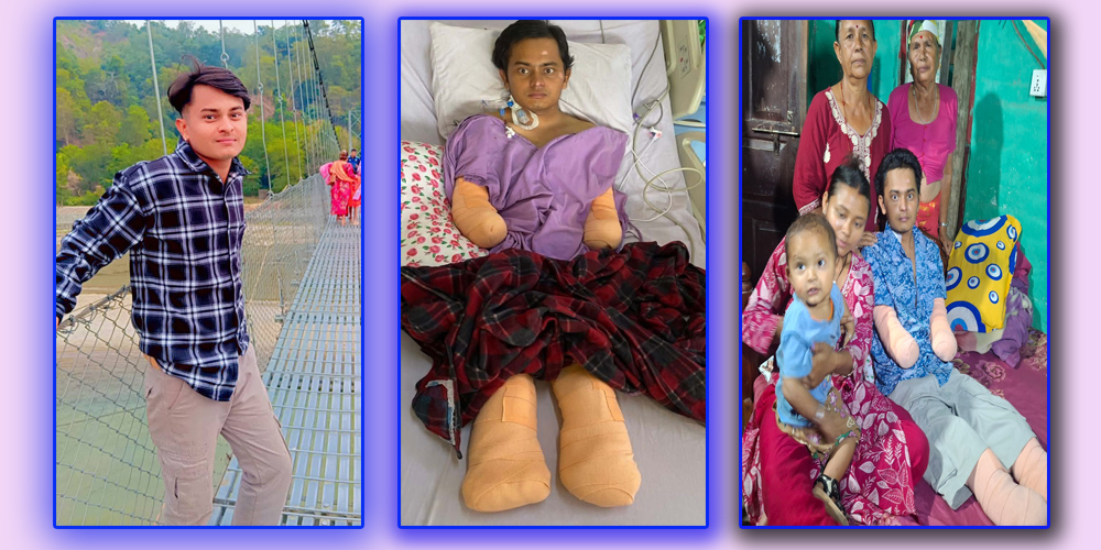 अबुधाबीमा संक्रमणपछि झापाका युवाका दुवै हात–खुट्टा काटियो